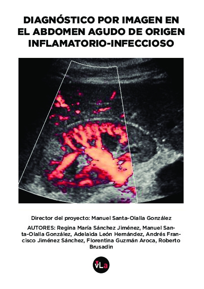 Diágnóstico por imagen en el abdomen agudo de origen inflamantorio-infeccioso
