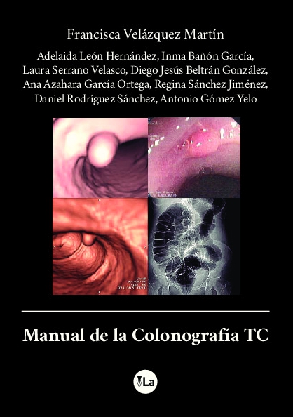 Manual de la Colonografía TC