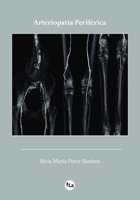 Arteriopatía Periférica