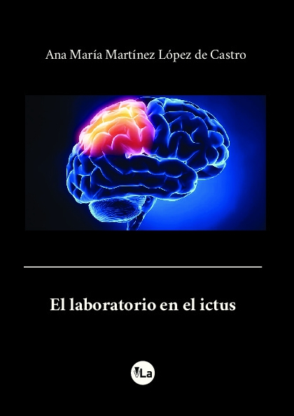 El laboratorio en el ictus