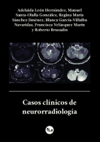 Casos clínicos de neurorradiología