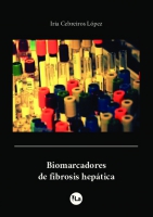 Biomarcadores de Fibrosis Hepática