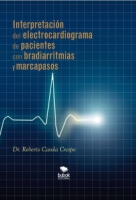 Interpretación del electrocardiograma de pacientes con bradiarritmias y marcapasos